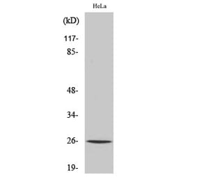 Western blot - UMP-CMP Kinase Polyclonal Antibody from Signalway Antibody (41523) - Antibodies.com