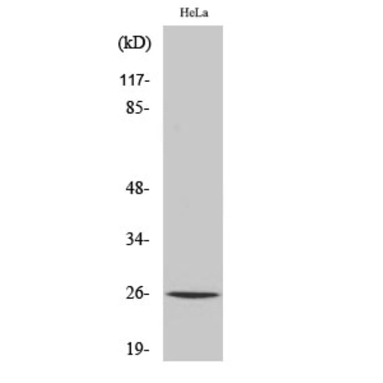 Western blot - UMP-CMP Kinase Polyclonal Antibody from Signalway Antibody (41523) - Antibodies.com