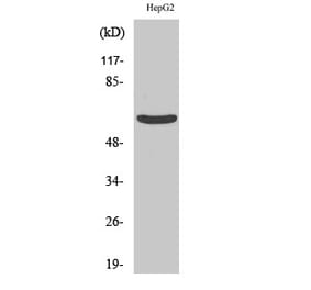 Western blot - Cytokeratin 5 Polyclonal Antibody from Signalway Antibody (40827) - Antibodies.com