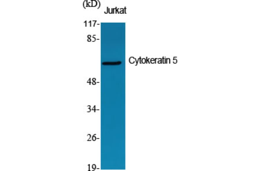 Western blot - Cytokeratin 5 Polyclonal Antibody from Signalway Antibody (40827) - Antibodies.com