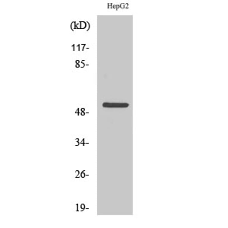 Western blot - Cytokeratin 7 Polyclonal Antibody from Signalway Antibody (40828) - Antibodies.com