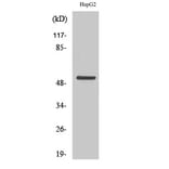 Western blot - Cytokeratin 7 Polyclonal Antibody from Signalway Antibody (40828) - Antibodies.com