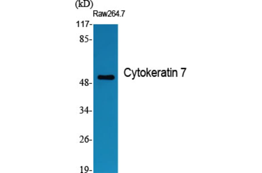 Western blot - Cytokeratin 7 Polyclonal Antibody from Signalway Antibody (40828) - Antibodies.com