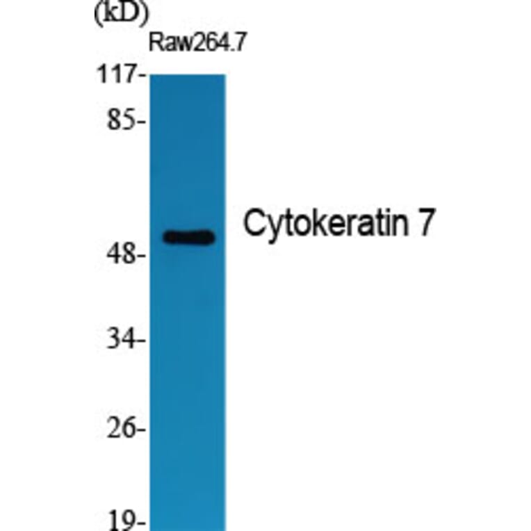 Western blot - Cytokeratin 7 Polyclonal Antibody from Signalway Antibody (40828) - Antibodies.com