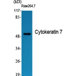 Western blot - Cytokeratin 7 Polyclonal Antibody from Signalway Antibody (40828) - Antibodies.com