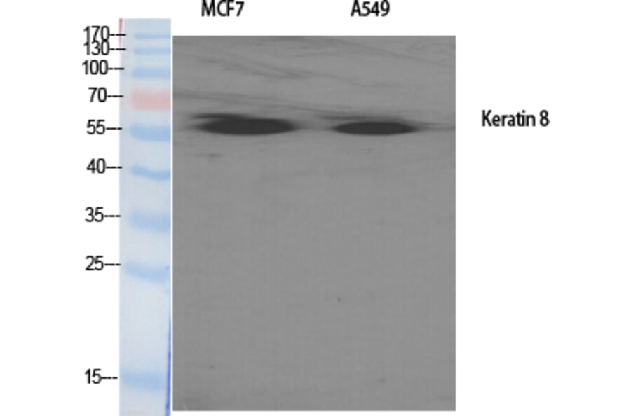 Western blot - Cytokeratin 8 Polyclonal Antibody from Signalway Antibody (40829) - Antibodies.com