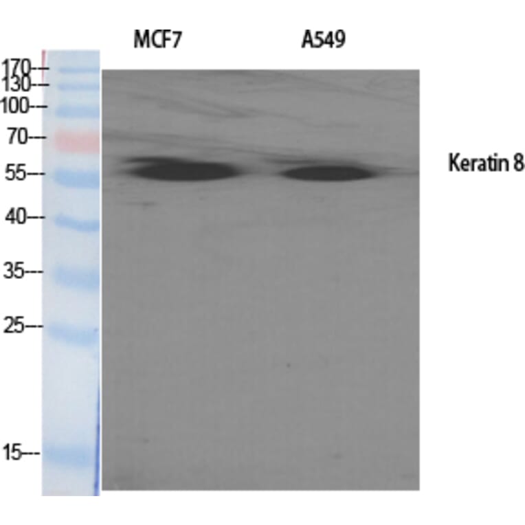 Western blot - Cytokeratin 8 Polyclonal Antibody from Signalway Antibody (40829) - Antibodies.com