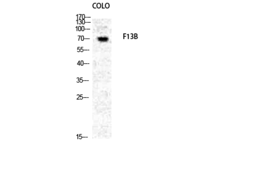 Western blot - Factor XIII B Polyclonal Antibody from Signalway Antibody (40911) - Antibodies.com