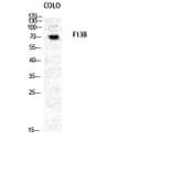 Western blot - Factor XIII B Polyclonal Antibody from Signalway Antibody (40911) - Antibodies.com