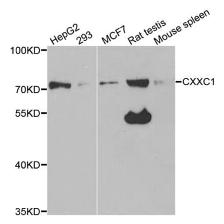 Western blot - CXXC1 Antibody from Signalway Antibody (33061) - Antibodies.com