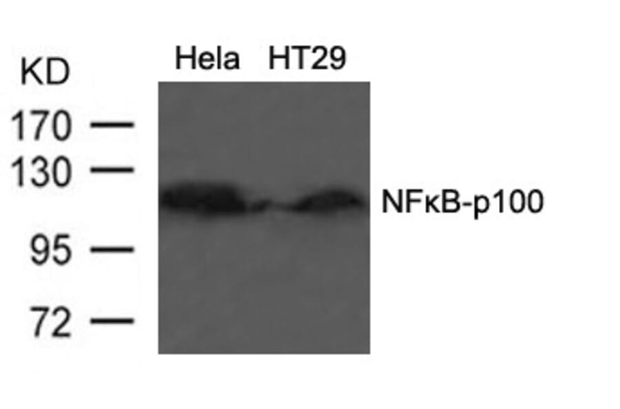 Western blot - NFkB-p100 (Ab-866) Antibody from Signalway Antibody (21015) - Antibodies.com