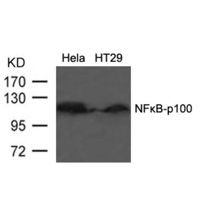 Western blot - NFkB-p100 (Ab-866) Antibody from Signalway Antibody (21015) - Antibodies.com