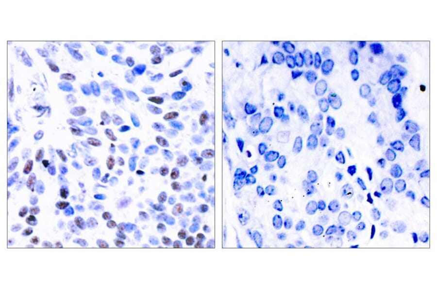 Immunohistochemistry - NFkB-p100 (Ab-866) Antibody from Signalway Antibody (21015) - Antibodies.com