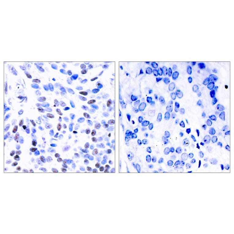 Immunohistochemistry - NFkB-p100 (Ab-866) Antibody from Signalway Antibody (21015) - Antibodies.com