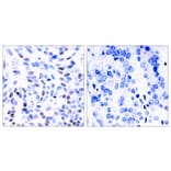 Immunohistochemistry - NFkB-p100 (Ab-866) Antibody from Signalway Antibody (21015) - Antibodies.com