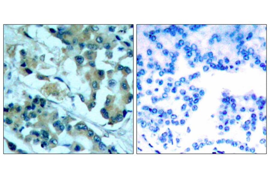 Immunohistochemistry - MEK1/MEK2 (Ab-217/221) Antibody from Signalway Antibody (21203) - Antibodies.com