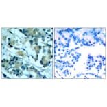 Immunohistochemistry - MEK1/MEK2 (Ab-217/221) Antibody from Signalway Antibody (21203) - Antibodies.com