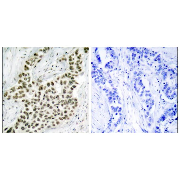 Immunohistochemistry - Histone H2A.X (Ab-139) Antibody from Signalway Antibody (21260) - Antibodies.com