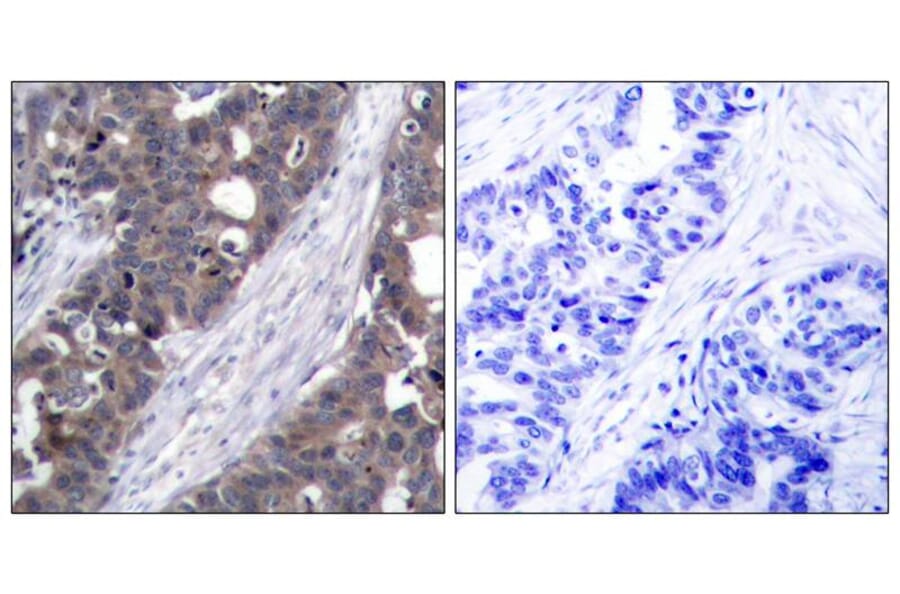 Immunohistochemistry - p70 S6 Kinase (Ab-411) Antibody from Signalway Antibody (21261) - Antibodies.com