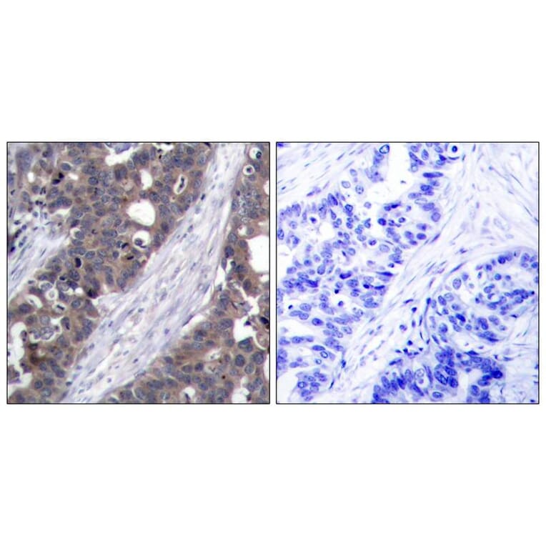 Immunohistochemistry - p70 S6 Kinase (Ab-411) Antibody from Signalway Antibody (21261) - Antibodies.com
