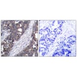Immunohistochemistry - p70 S6 Kinase (Ab-411) Antibody from Signalway Antibody (21261) - Antibodies.com