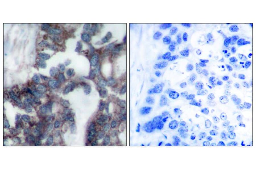 Immunohistochemistry - p70 S6 Kinase (Ab-424) Antibody from Signalway Antibody (21276) - Antibodies.com