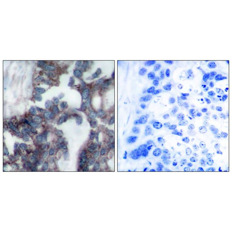 Immunohistochemistry - p70 S6 Kinase (Ab-424) Antibody from Signalway Antibody (21276) - Antibodies.com