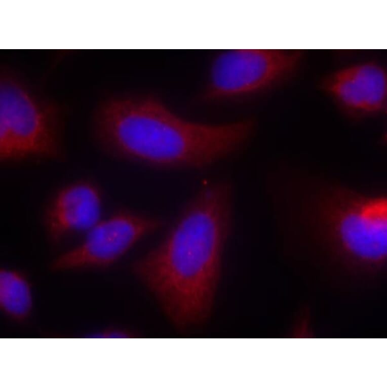 Immunofluorescence - p70 S6 Kinase (Ab-424) Antibody from Signalway Antibody (21276) - Antibodies.com