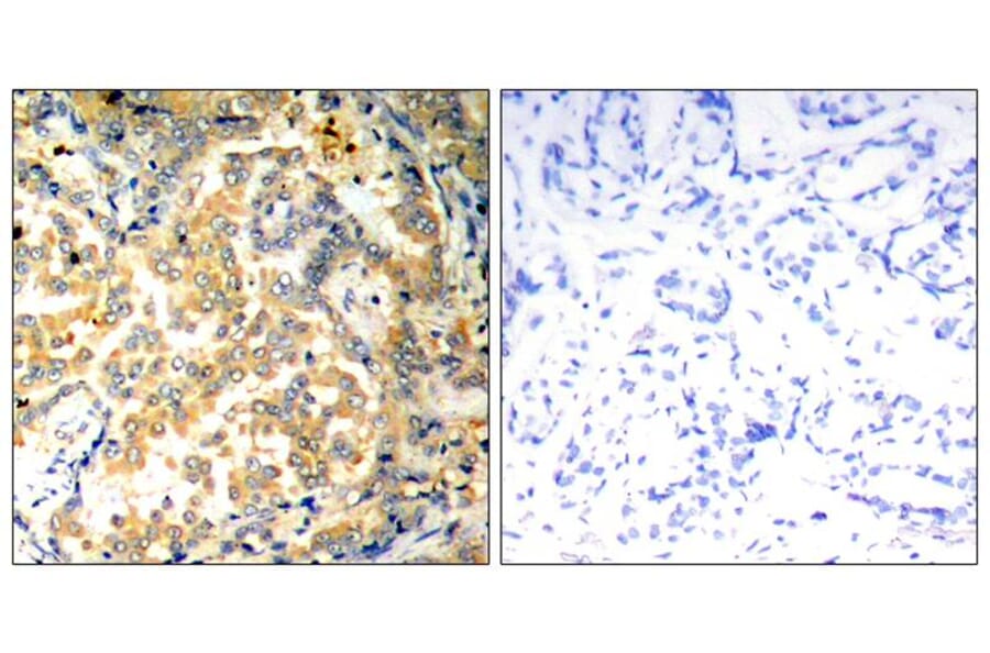 Immunohistochemistry - NFkB-p100 (Ab-872) Antibody from Signalway Antibody (21297) - Antibodies.com