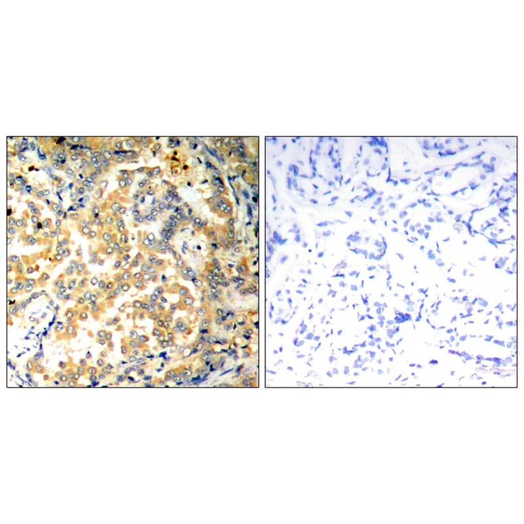 Immunohistochemistry - NFkB-p100 (Ab-872) Antibody from Signalway Antibody (21297) - Antibodies.com