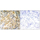 Immunohistochemistry - NFkB-p100 (Ab-872) Antibody from Signalway Antibody (21297) - Antibodies.com