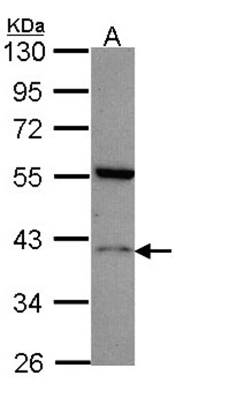 Anti-Histamine H2 Receptor Antibody (A34580) | Antibodies.com