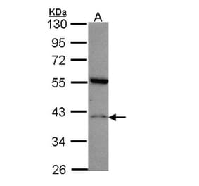 Histamine H2 Receptor antibody from Signalway Antibody (22532) - Antibodies.com