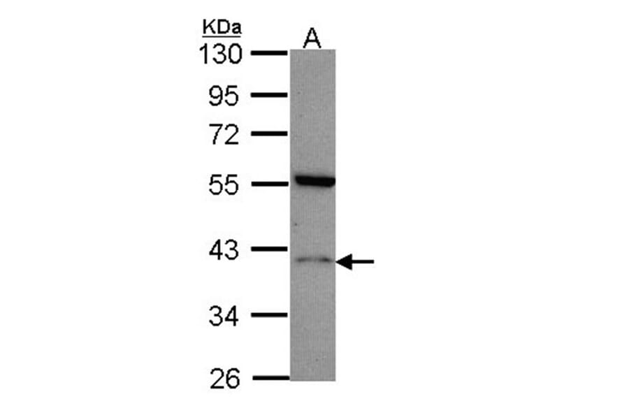 Histamine H2 Receptor antibody from Signalway Antibody (22532) - Antibodies.com