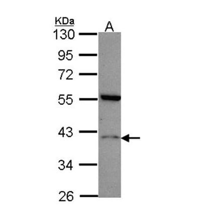 Histamine H2 Receptor antibody from Signalway Antibody (22532) - Antibodies.com