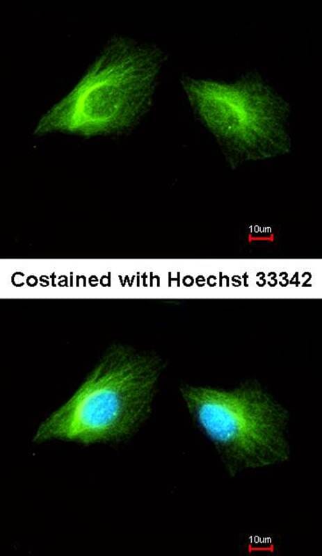 はく。ページ　Sinai Anti-Histamine H2 Receptor Antibody (A34580) | Antibodies.com