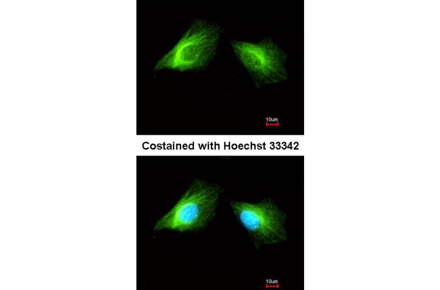 Immunofluorescence - Histamine H2 Receptor antibody from Signalway Antibody (22532) - Antibodies.com