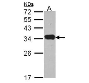 Protease Inhibitor 15 antibody from Signalway Antibody (22711) - Antibodies.com
