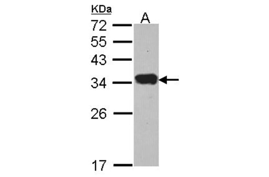 Protease Inhibitor 15 antibody from Signalway Antibody (22711) - Antibodies.com