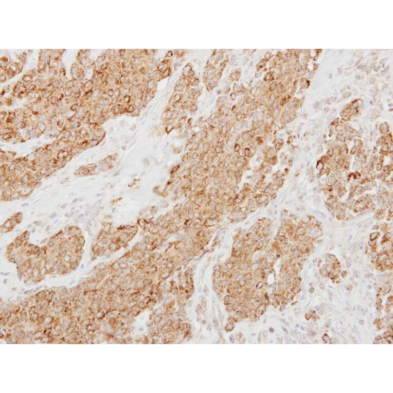 Immunohistochemistry - Protease Inhibitor 15 antibody from Signalway Antibody (22711) - Antibodies.com