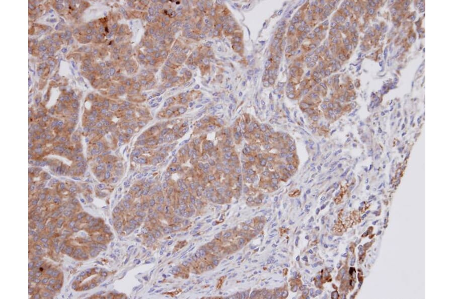 Immunohistochemistry - Dipeptidyl-peptidase 3 antibody from Signalway Antibody (22743) - Antibodies.com