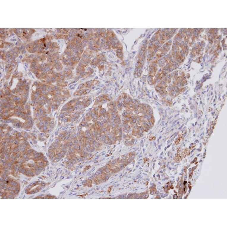 Immunohistochemistry - Dipeptidyl-peptidase 3 antibody from Signalway Antibody (22743) - Antibodies.com