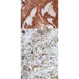 Immunohistochemistry - CD44 antigen isoform 4 antibody from Signalway Antibody (22981) - Antibodies.com