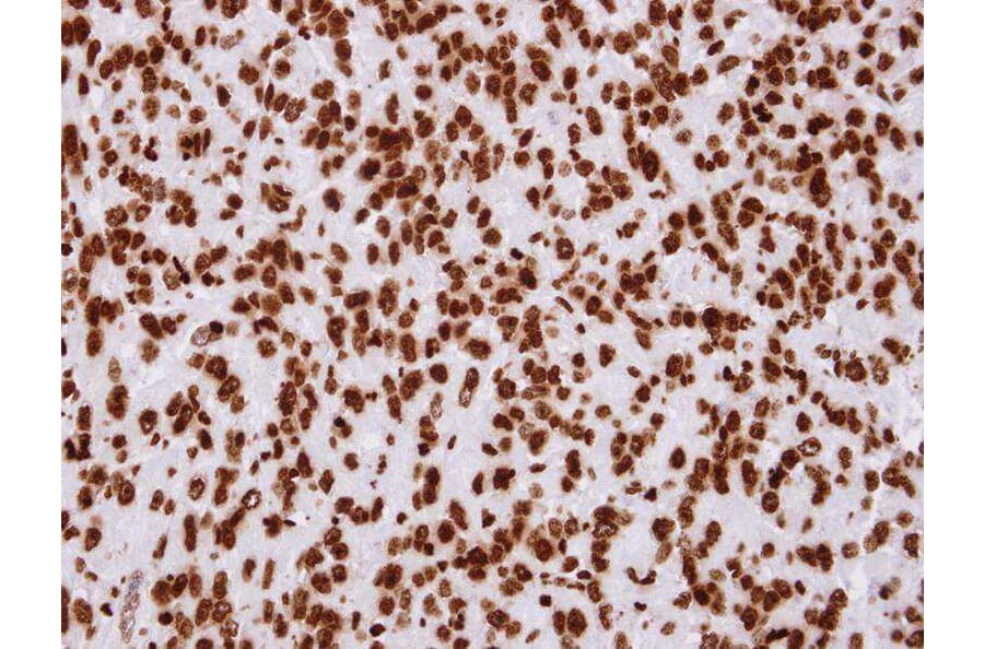 Immunohistochemistry - Histone H2A.Z/H2A.F/Z antibody from Signalway Antibody (23010) - Antibodies.com
