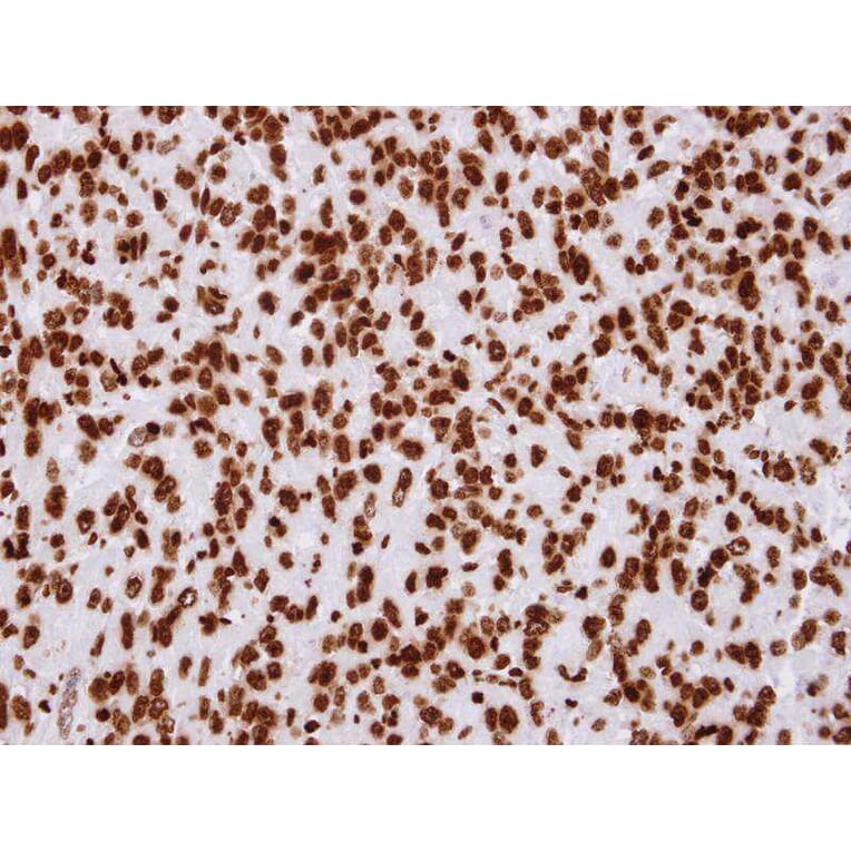 Immunohistochemistry - Histone H2A.Z/H2A.F/Z antibody from Signalway Antibody (23010) - Antibodies.com