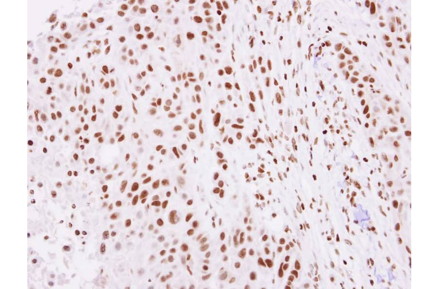 Immunohistochemistry - Histone H2A.Z/H2A.F/Z antibody from Signalway Antibody (23011) - Antibodies.com