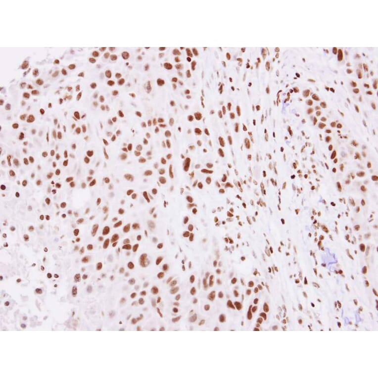 Immunohistochemistry - Histone H2A.Z/H2A.F/Z antibody from Signalway Antibody (23011) - Antibodies.com