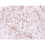 Immunohistochemistry - Histone H2A.Z/H2A.F/Z antibody from Signalway Antibody (23011) - Antibodies.com