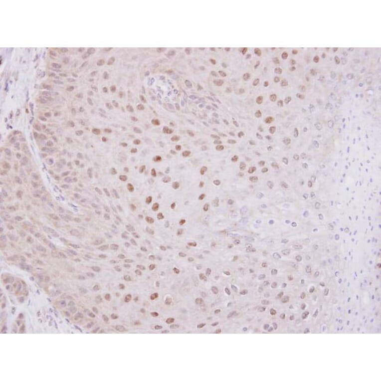 Immunohistochemistry - O-GlcNAc transferase antibody from Signalway Antibody (22476) - Antibodies.com
