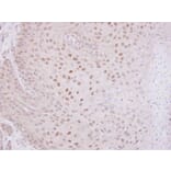 Immunohistochemistry - O-GlcNAc transferase antibody from Signalway Antibody (22476) - Antibodies.com